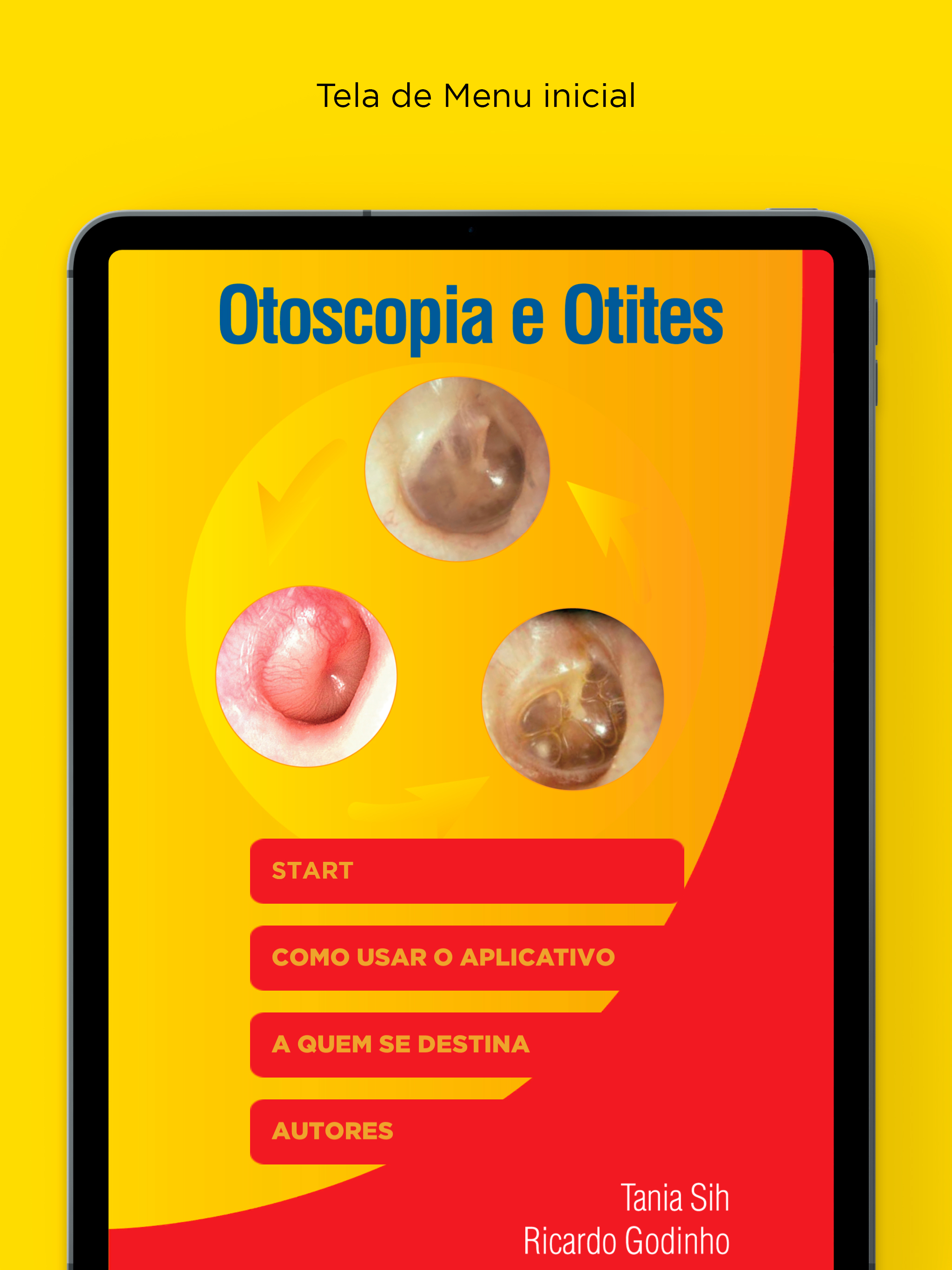 Otoscopia e Otites